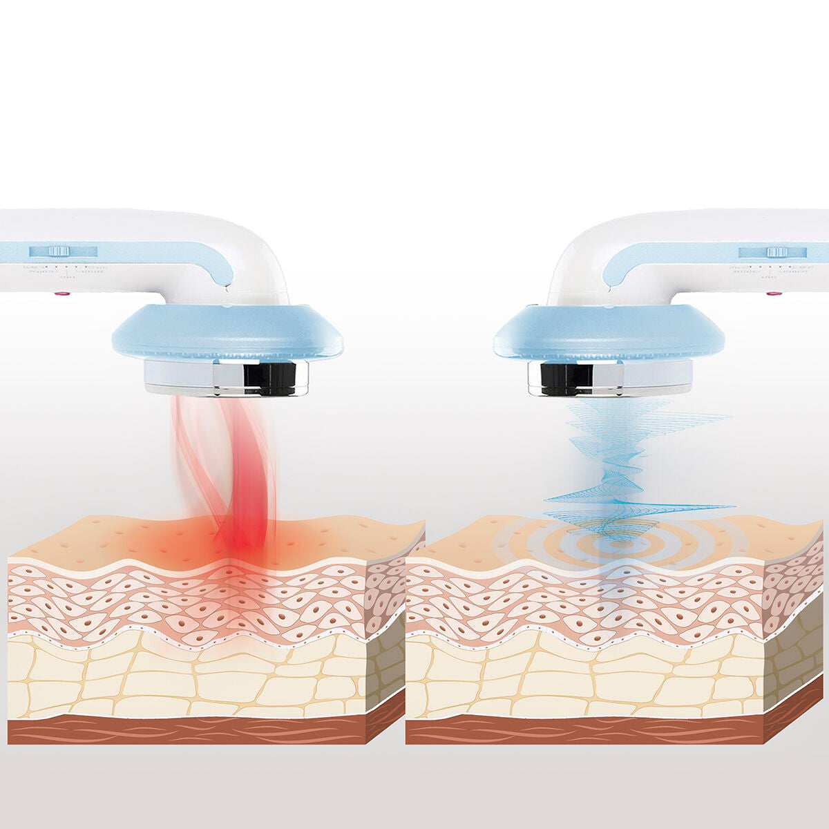 Ultraschall-Kavitations-Anti-Cellulite-Massagegerät mit Infrarot und Elektrostimulation 3 in 1 CellyMax InnovaGoods 